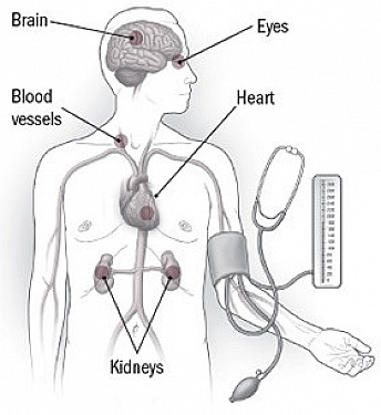 When should we treat blood pressure? featured image