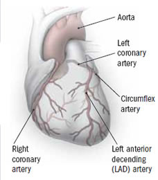 can you live with a 100 blocked artery