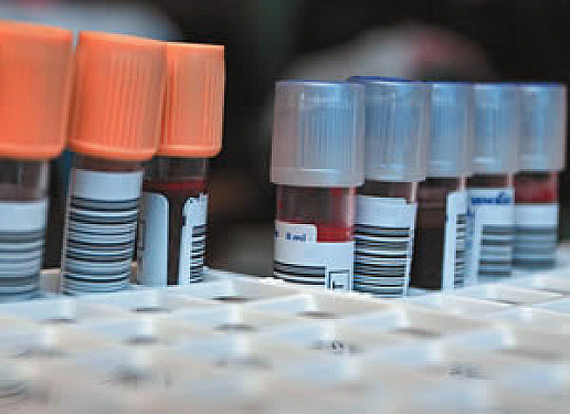 The lesser-known fat in your blood featured image