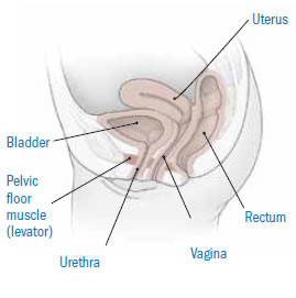 FemiCushion: Pelvic Organ Prolapse Treatment for Bladder, Uterine,  Rectocele, Enterocele