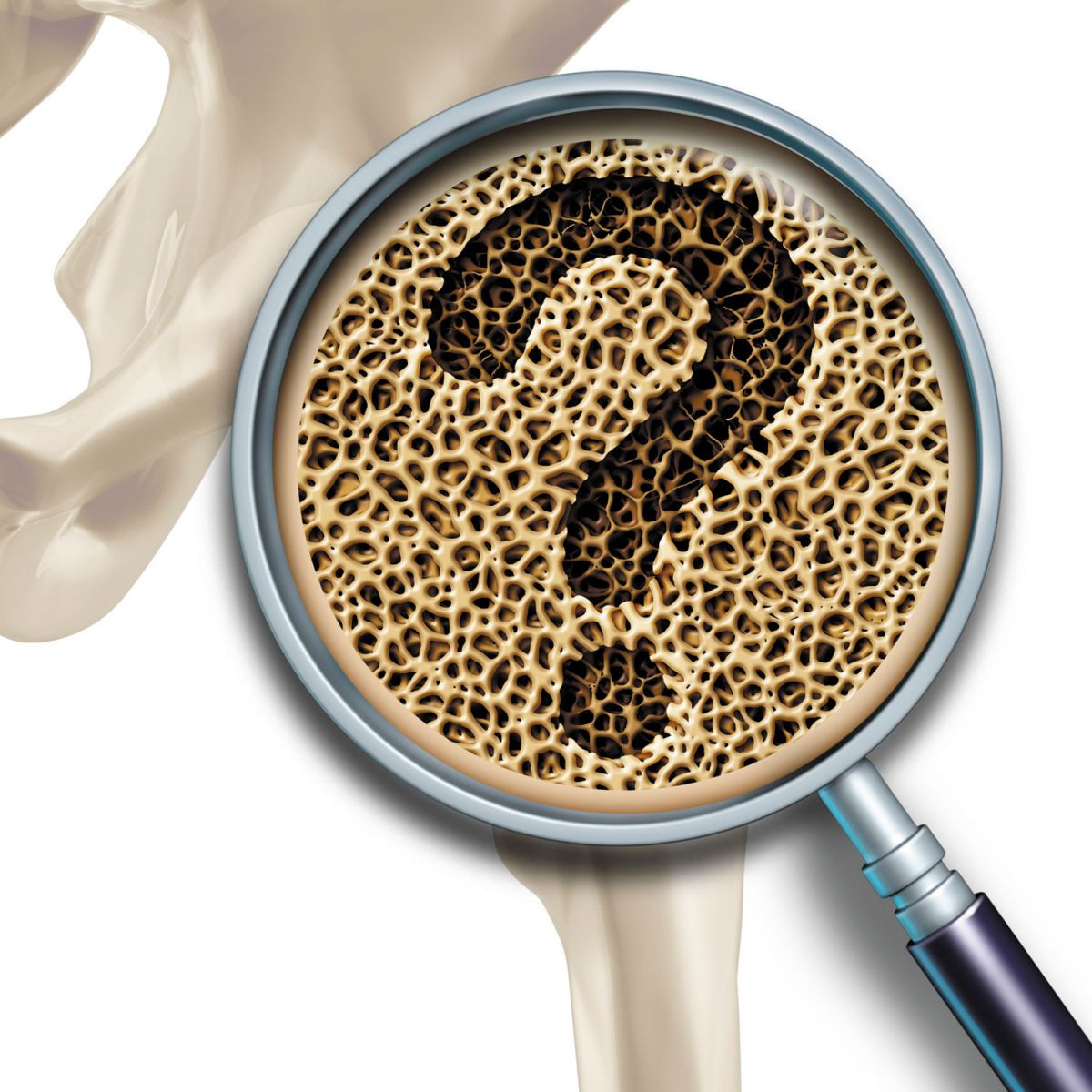 Should you be tested for weak bones? 