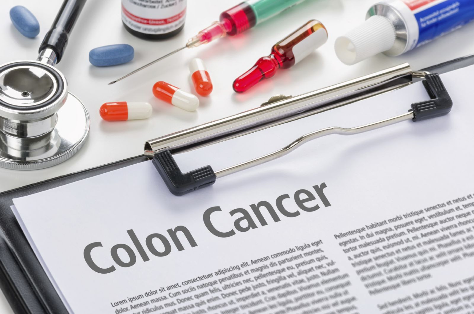 Colon cancer testing: What's in it for you?