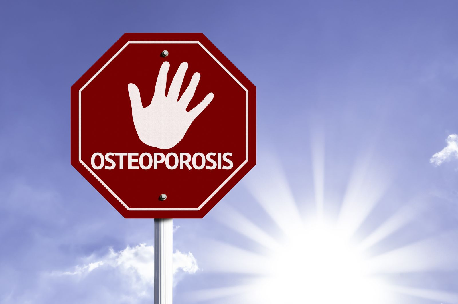 Do you need a drug for osteoporosis?