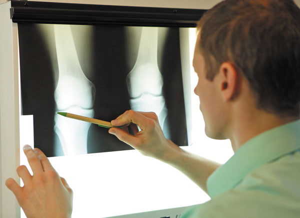 screening tool for diagnosing knee pain