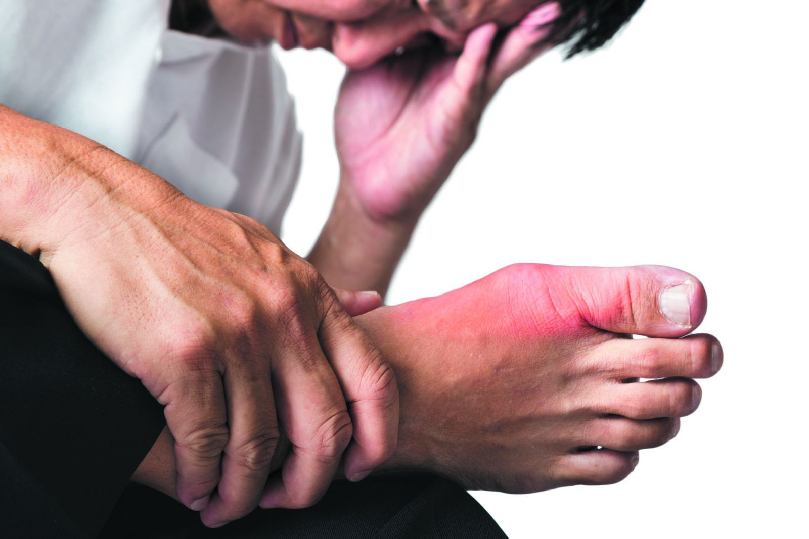 Are you at risk for gout?