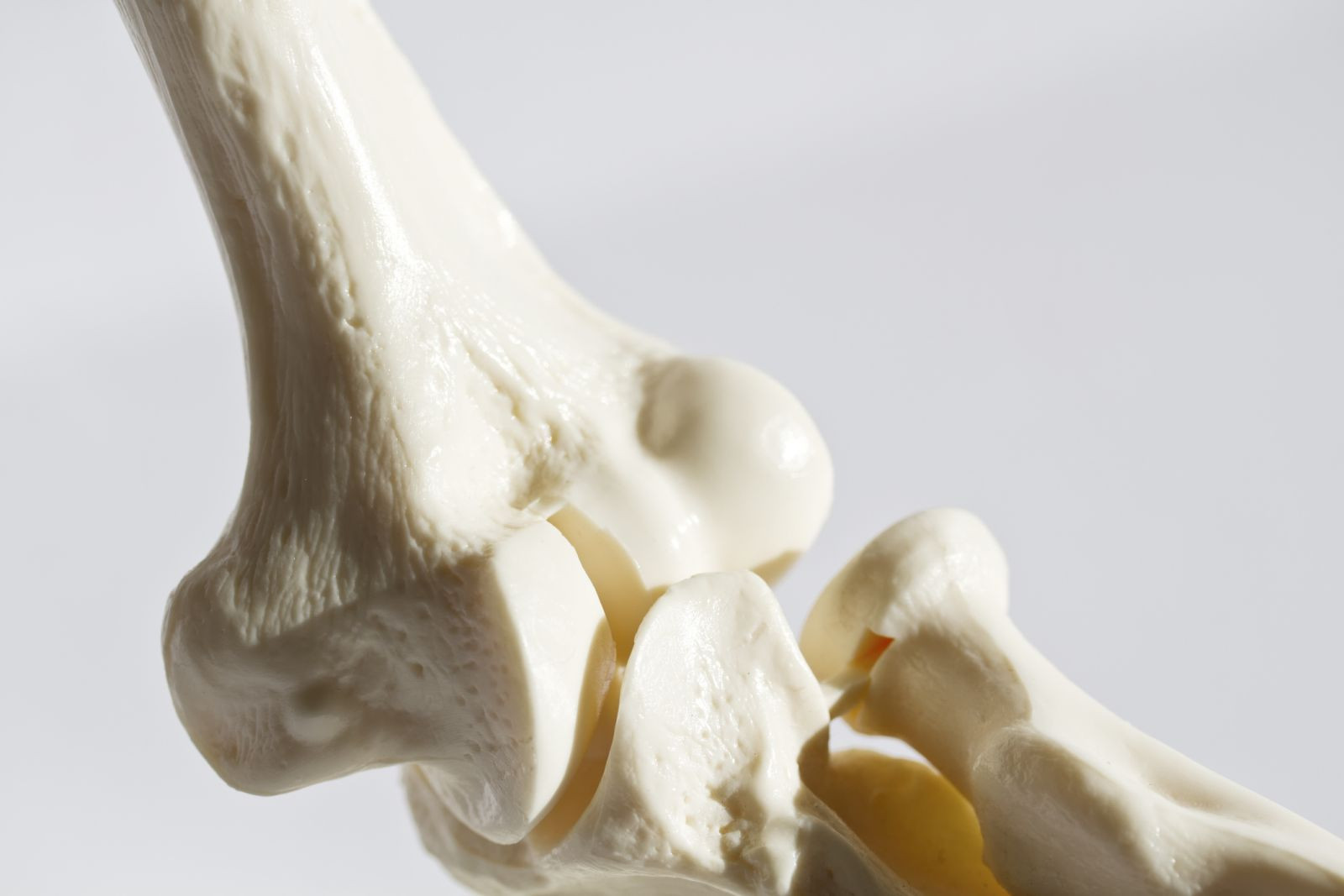 Does osteoporosis cause any symptoms?