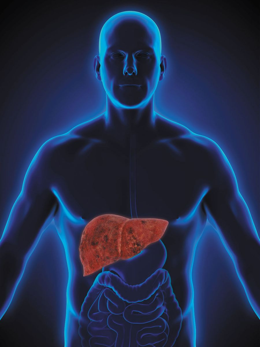 The skinny on fatty liver disease