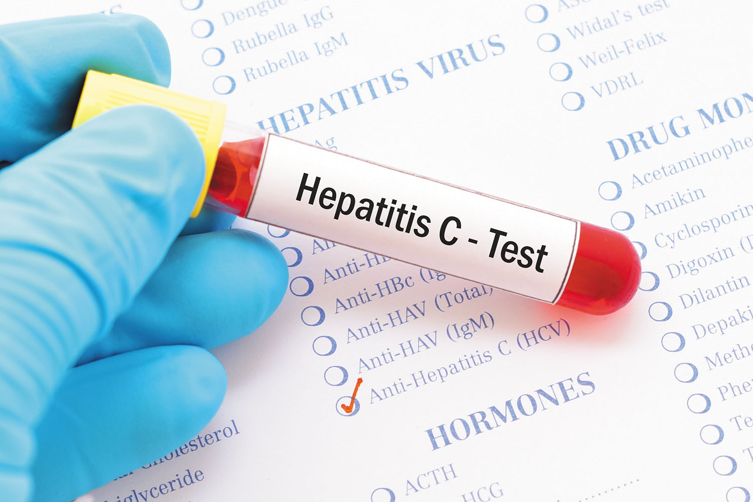 Should I get tested for hepatitis C?