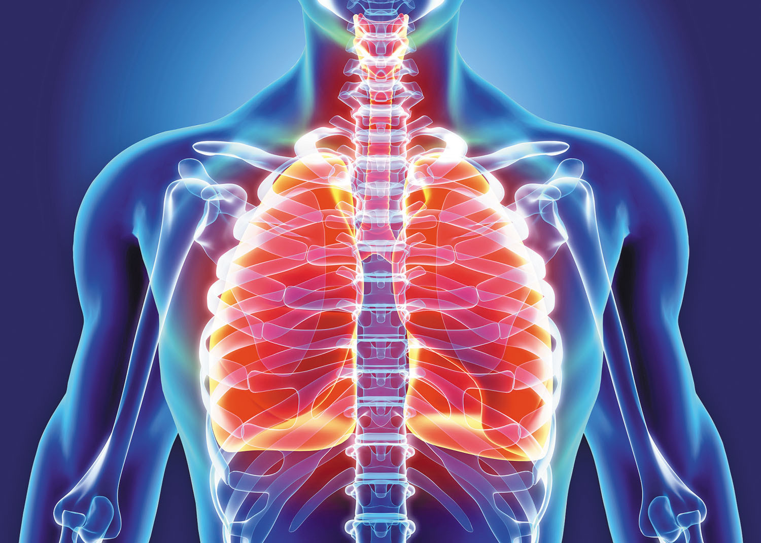 What causes acute bronchitis?