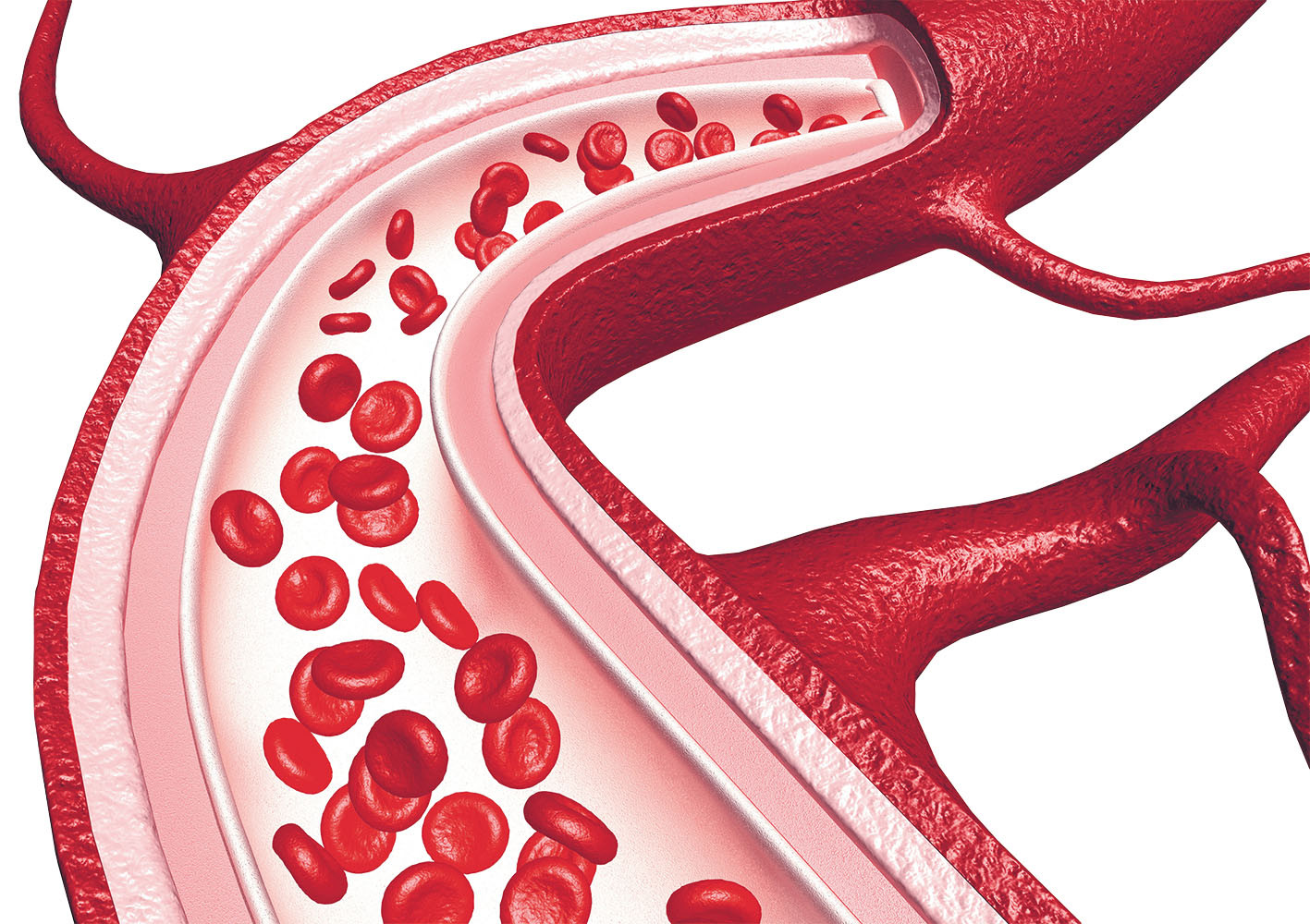 More antidotes for newer blood thinners - Harvard Health