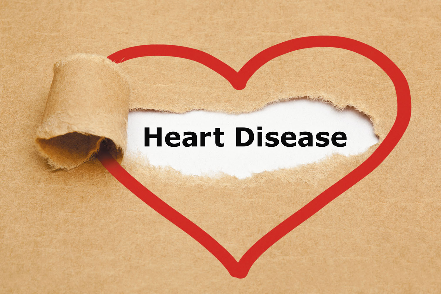 Finding hidden risk for heart disease