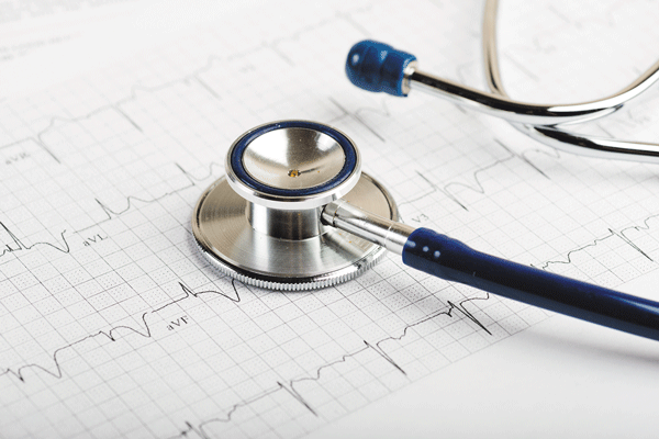 Atrial fibrillation may increase your risk of dementia