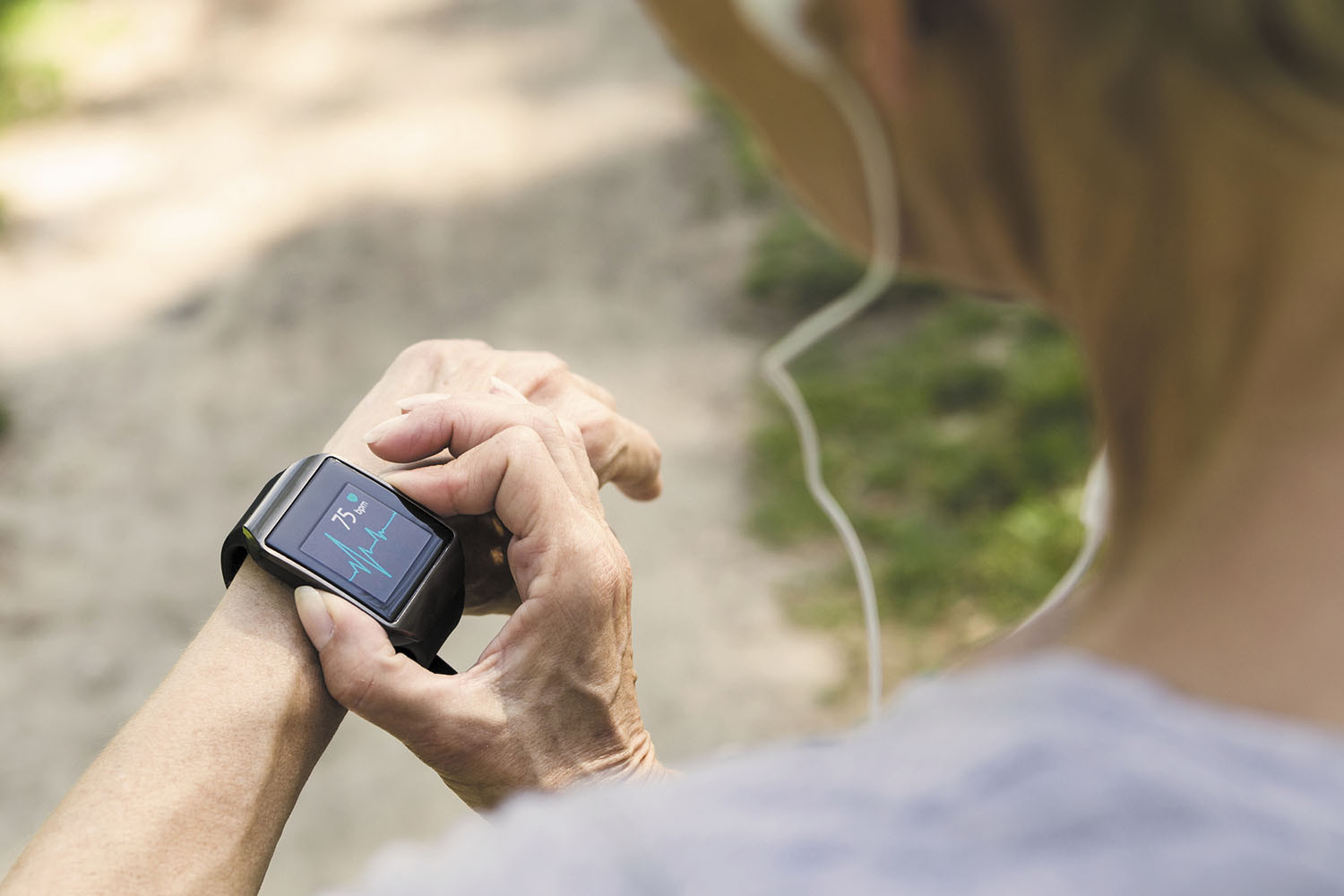 Heart rhythm monitoring with a smartwatch