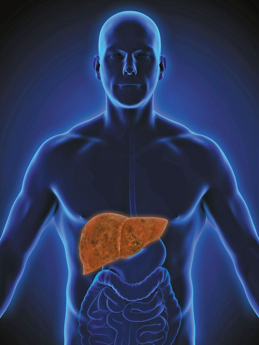 Fatty liver disease: An often-silent condition linked to heart disease