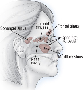 Acute Sinusitis Harvard Health