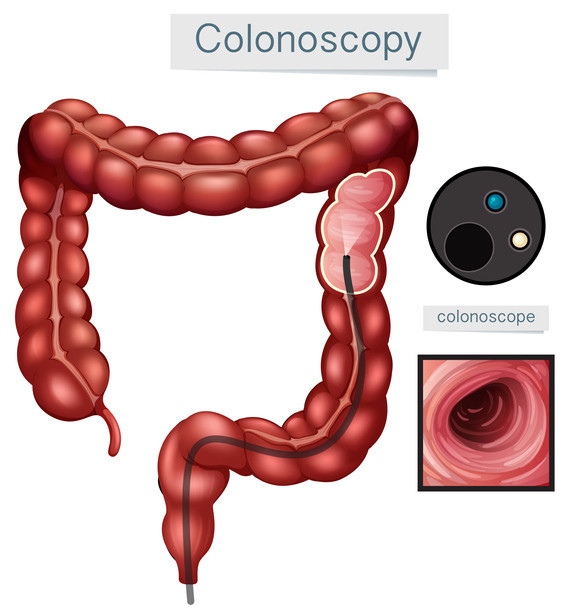 44173f02-778d-4413-9c27-2a14605dff9a