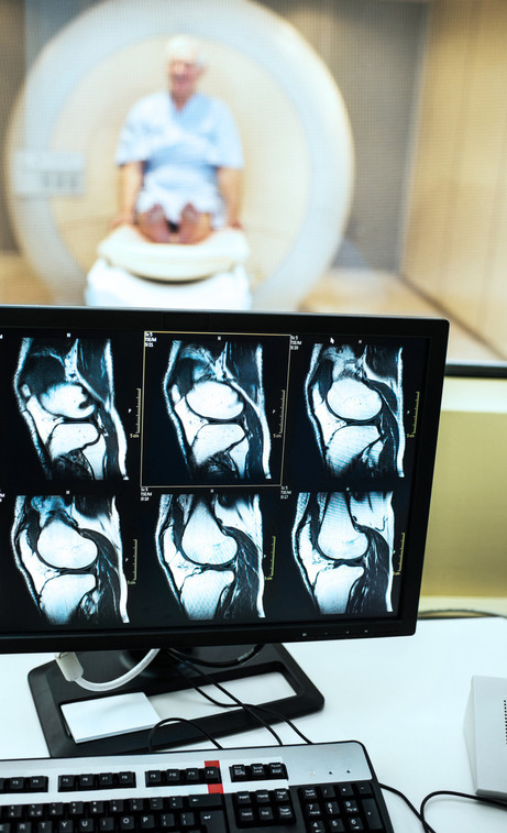 /media/content/images/medical-illustrations/knee-mri-gettyImages-170006131.jpg