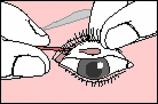 Emergencies and First Aid - Removing a Speck From the Eye featured image