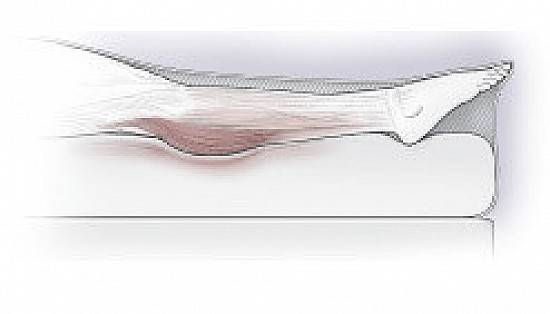 Leg Cramps — TheFamily Health Guide featured image