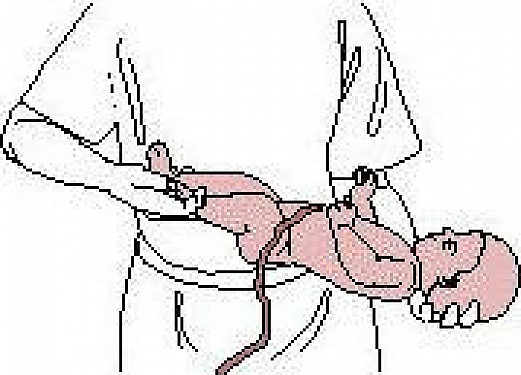 Emergencies and First Aid - Childbirth featured image