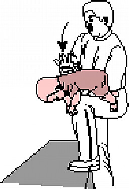 Emergencies and First Aid - Heimlich Maneuver on an Infant featured image