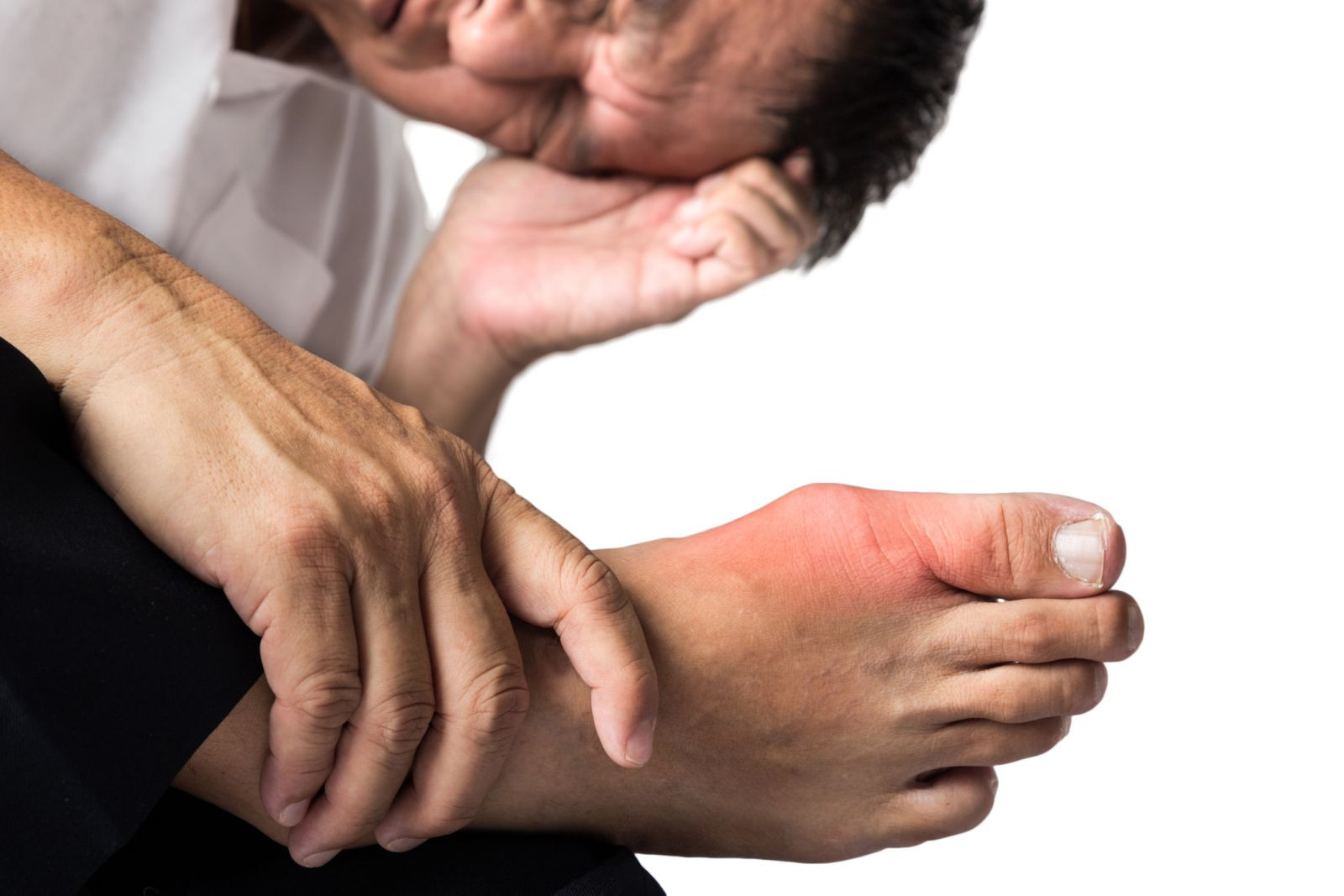 Gout: Inflammation and your joints