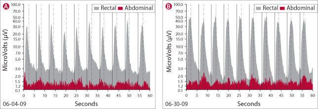 What biofeedback shows