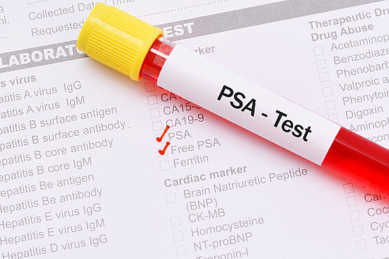 What is the difference between PSA and free PSA? - Harvard Health