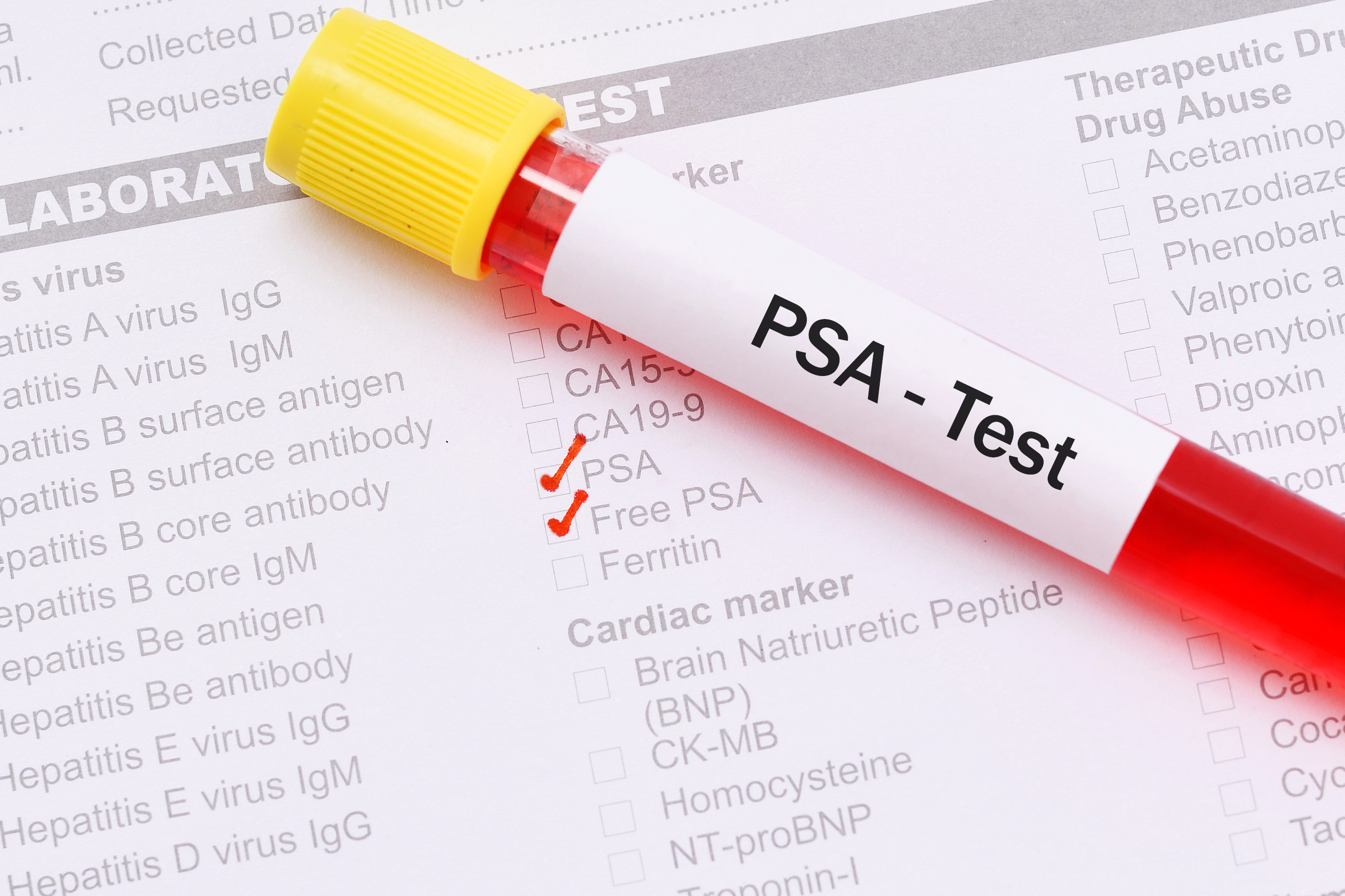 What is the difference between PSA and free PSA?