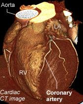 “Just in case” heart tests can do more harm than good