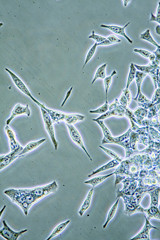 Prostate-cancer-cells