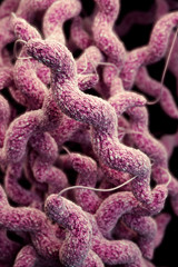 Drug-resistant bacteria a growing health problem