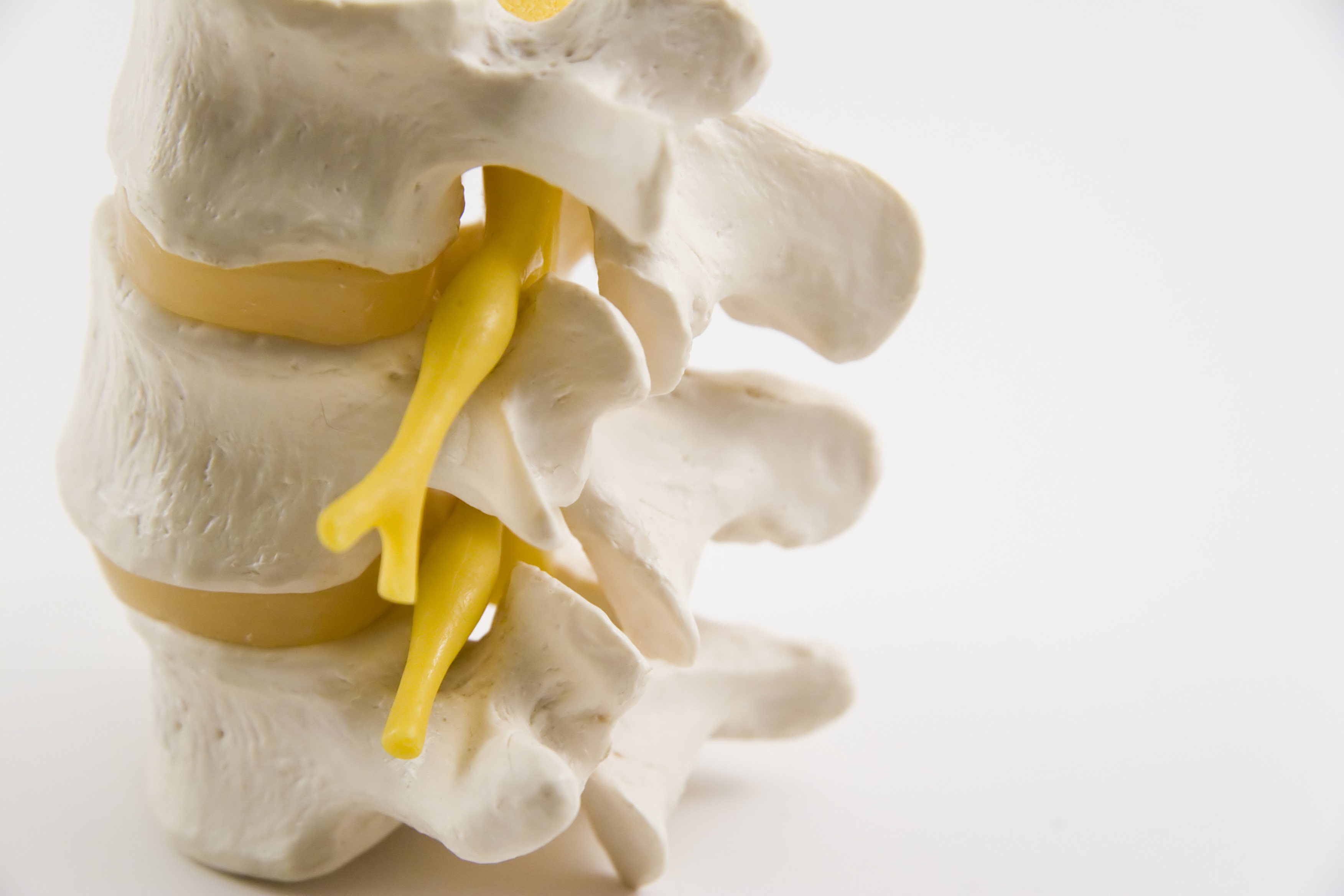 New recommendations aim to improve safety of pain-relieving spinal steroid injections