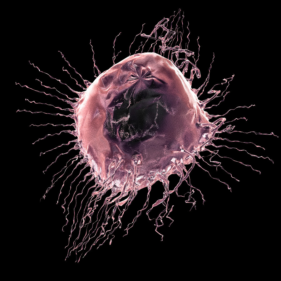 bigstock-Breast-cancer-cell-6997563