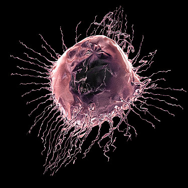 Untangling the non-invasive breast cancer controversy featured image