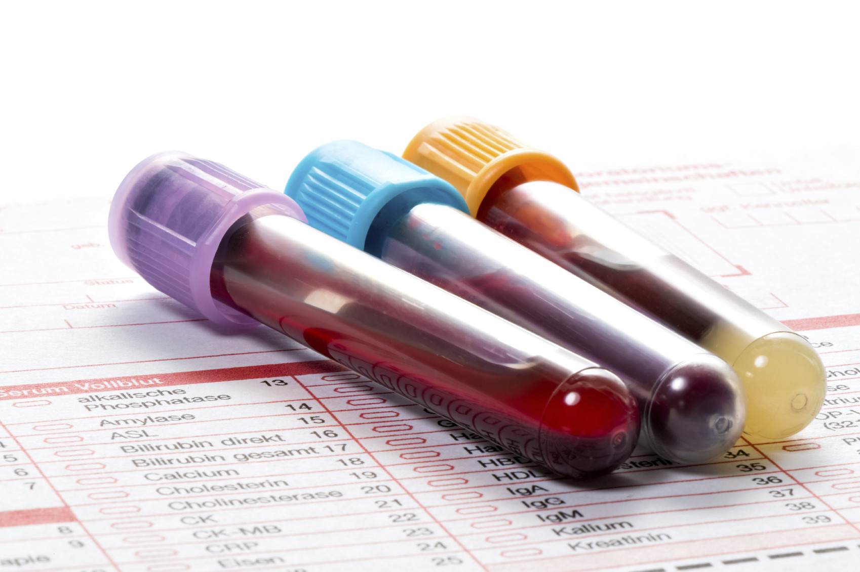 What to do when blood test results are not quite “normal” - Harvard Health