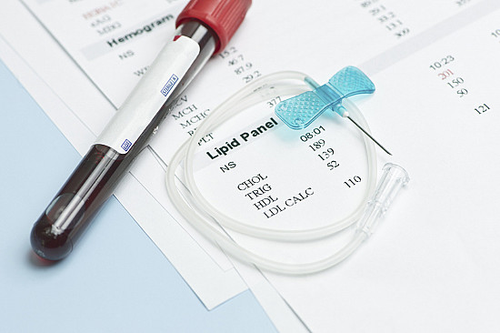 Farewell To The Fasting Cholesterol Test Harvard Health