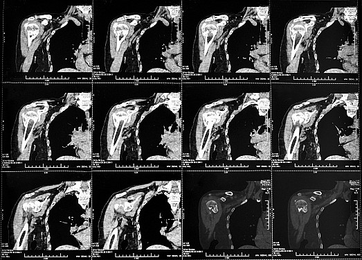 Taking advantage of incidental findings featured image
