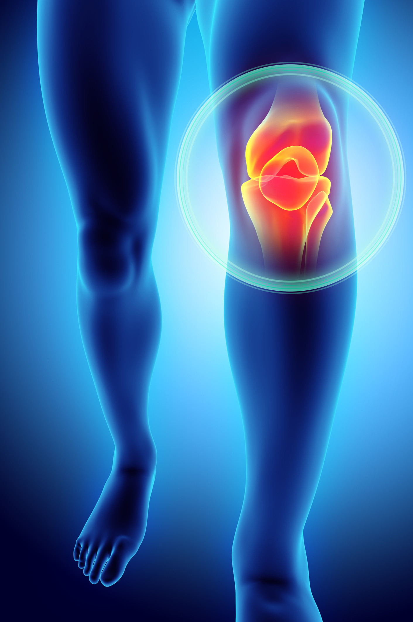 knee pain images