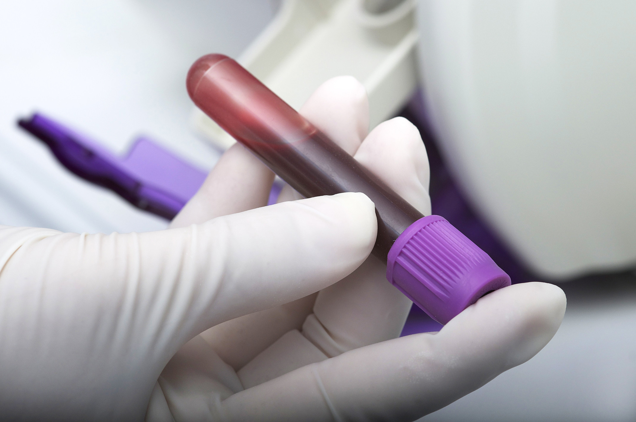 New blood test may someday help guide the best treatment for aggressive prostate cancer