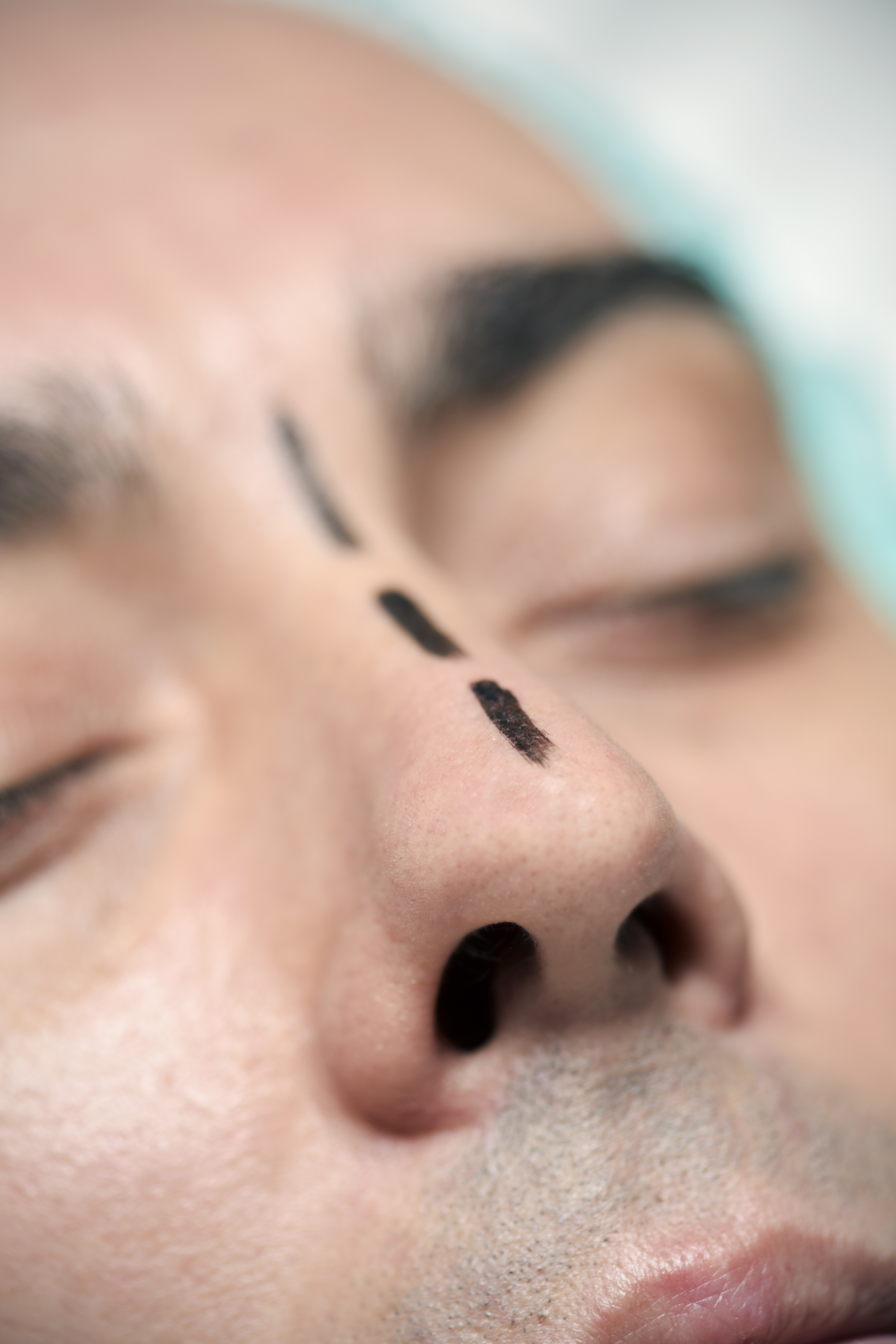 Thinking about rhinoplasty? - Harvard Health