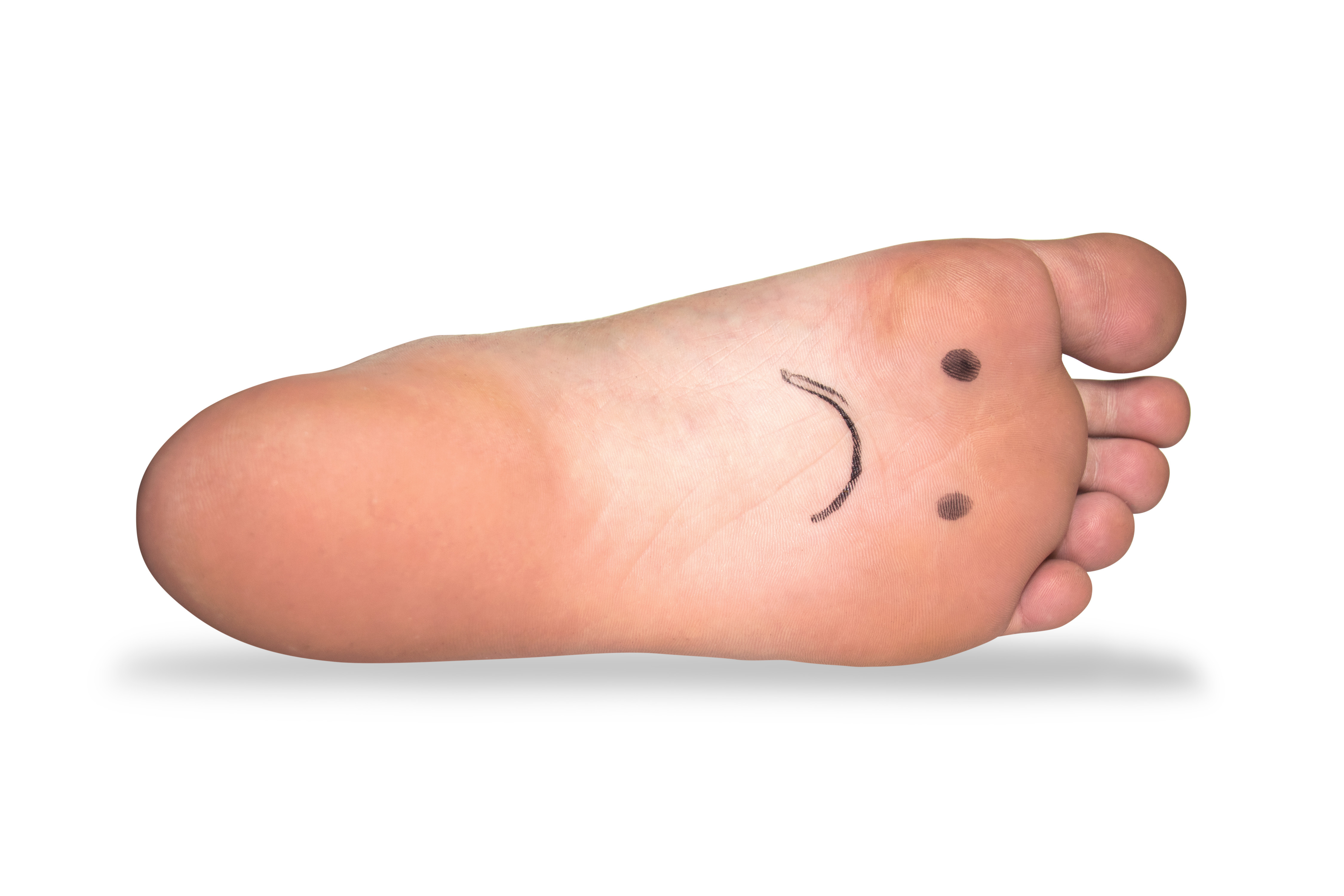 Realign your toes, relieve foot pain and restore healthy foot function