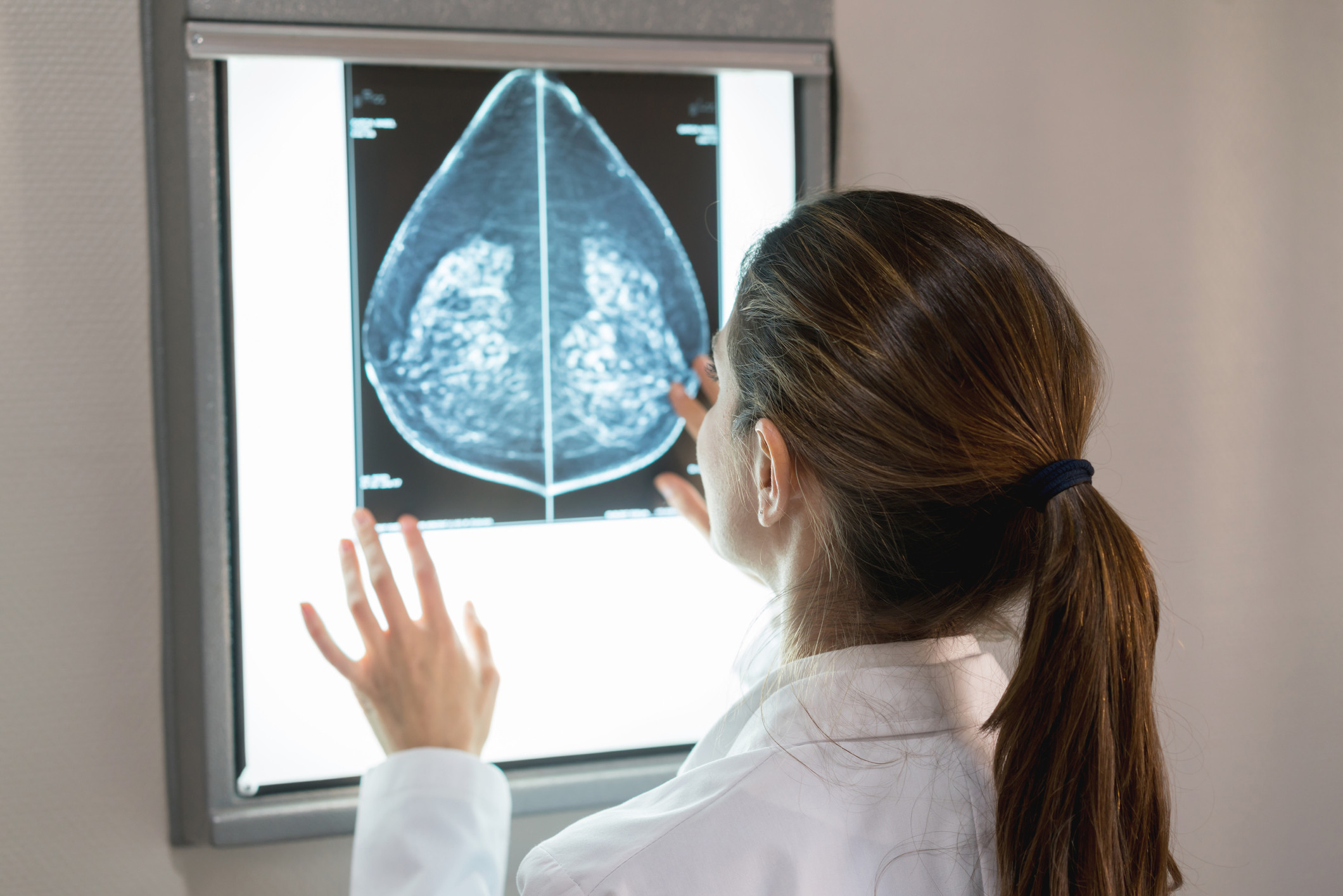 Dense breasts on a mammogram? What to know and do - Harvard Health