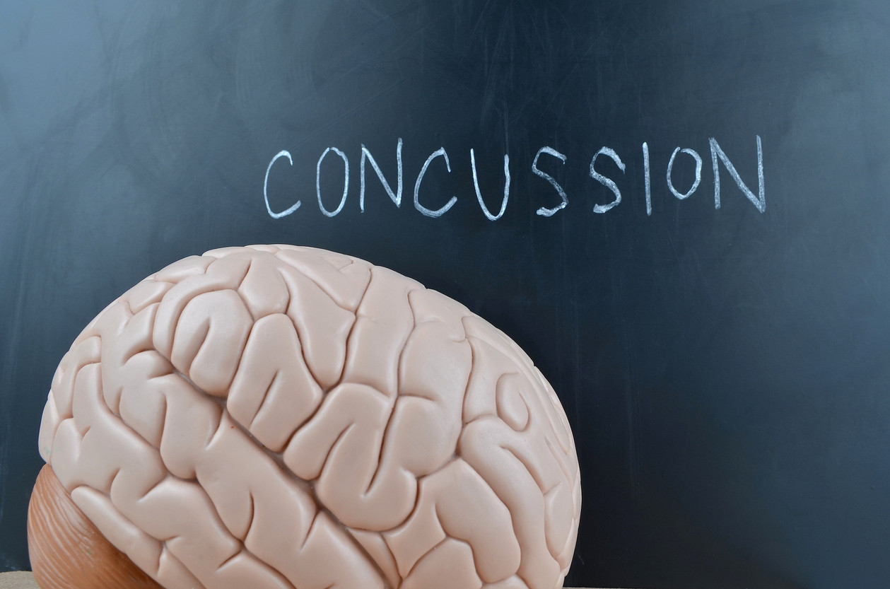 How to Tell If You Have a Concussion